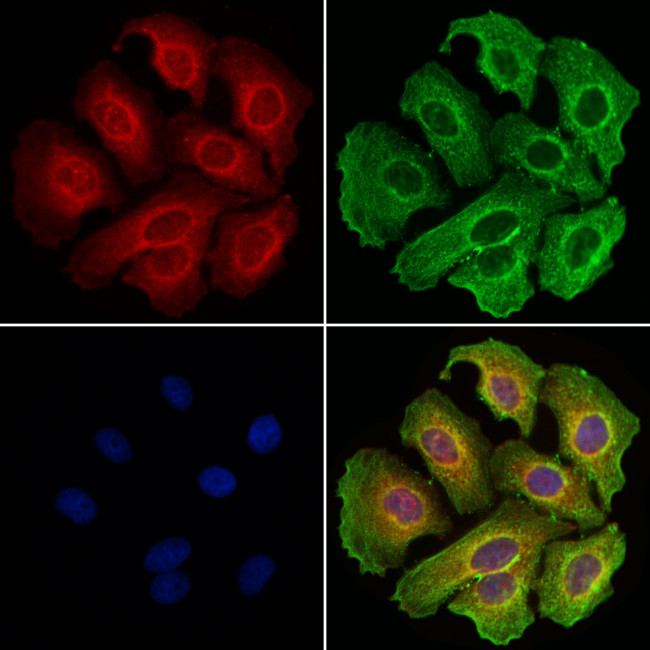 CD20 Antibody in Immunocytochemistry (ICC/IF)