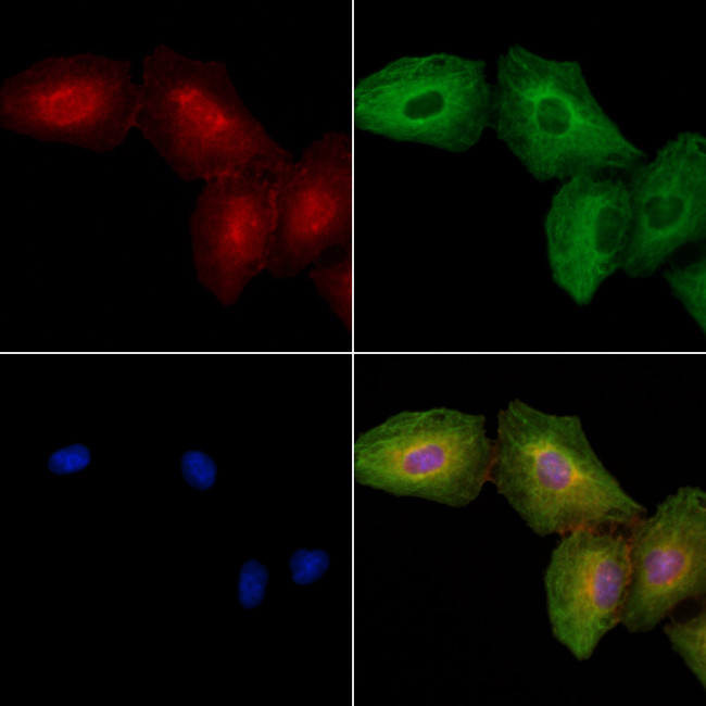 CD203c Antibody in Immunocytochemistry (ICC/IF)