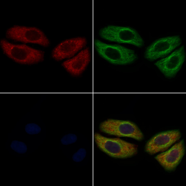 CD248 Antibody in Immunocytochemistry (ICC/IF)