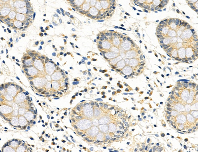CD44 Antibody in Immunohistochemistry (Paraffin) (IHC (P))