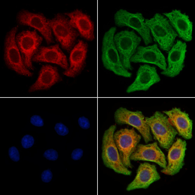 CD64 Antibody in Immunocytochemistry (ICC/IF)