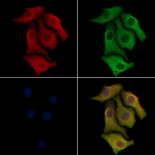 CD69 Antibody in Immunocytochemistry (ICC/IF)