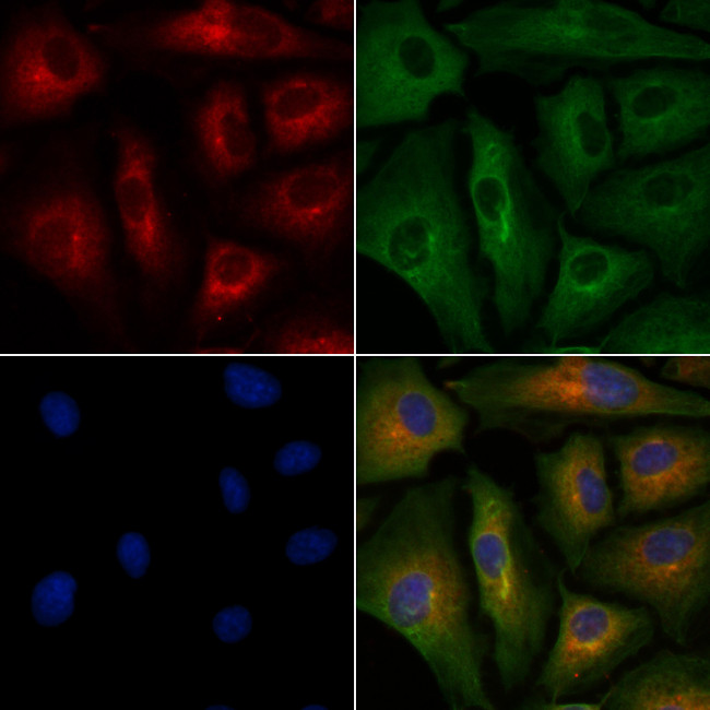 CD7 Antibody in Immunocytochemistry (ICC/IF)
