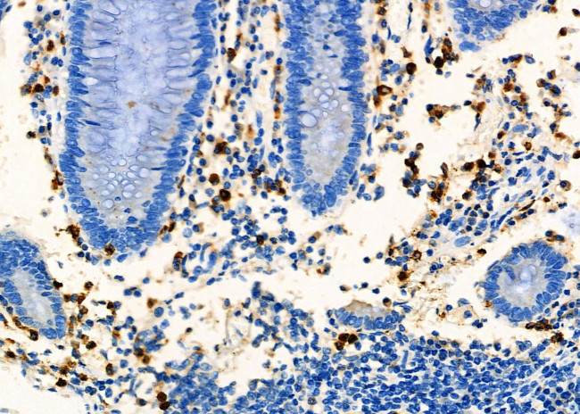 CD8 Antibody in Immunohistochemistry (Paraffin) (IHC (P))