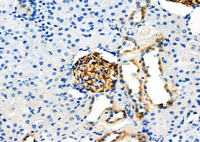 CD80 Antibody in Immunohistochemistry (Paraffin) (IHC (P))