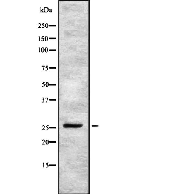 CD81 Antibody in Western Blot (WB)