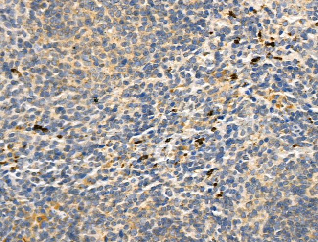 CD83 Antibody in Immunohistochemistry (Paraffin) (IHC (P))