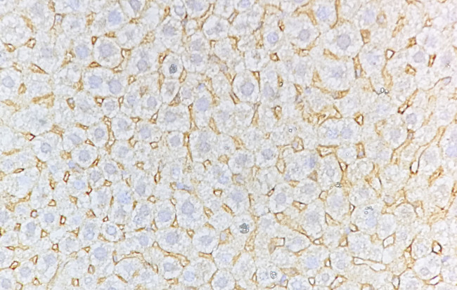 CD8 Antibody in Immunohistochemistry (Paraffin) (IHC (P))
