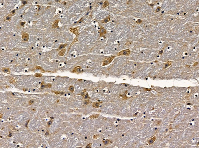 CDYL Antibody in Immunohistochemistry (Paraffin) (IHC (P))