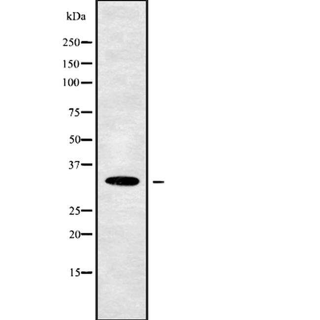 CENPQ Antibody in Western Blot (WB)