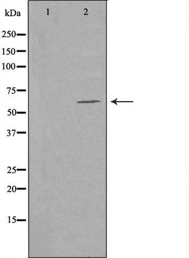 CERKL Antibody in Western Blot (WB)