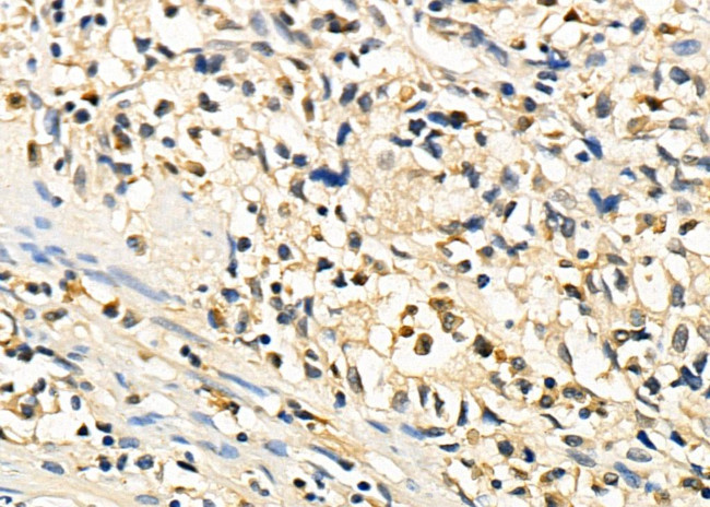 CHD1L Antibody in Immunohistochemistry (Paraffin) (IHC (P))
