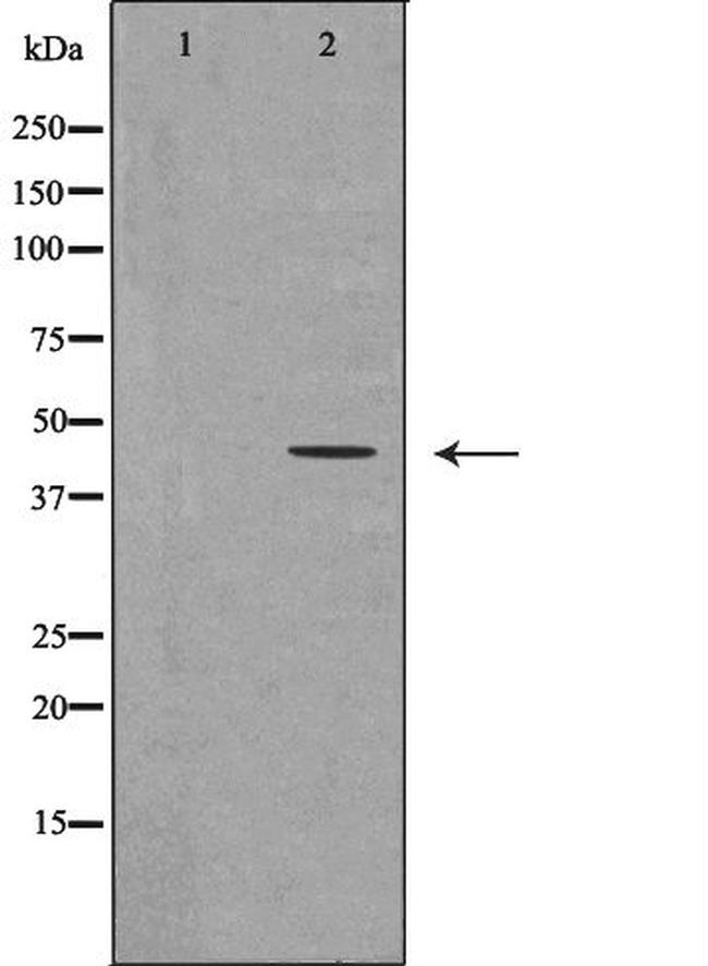 CHI3L1 Antibody in Western Blot (WB)