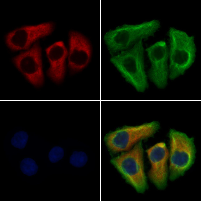 Chymotrypsin Antibody in Immunocytochemistry (ICC/IF)
