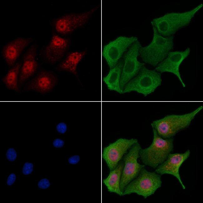CIDEA Antibody in Immunocytochemistry (ICC/IF)