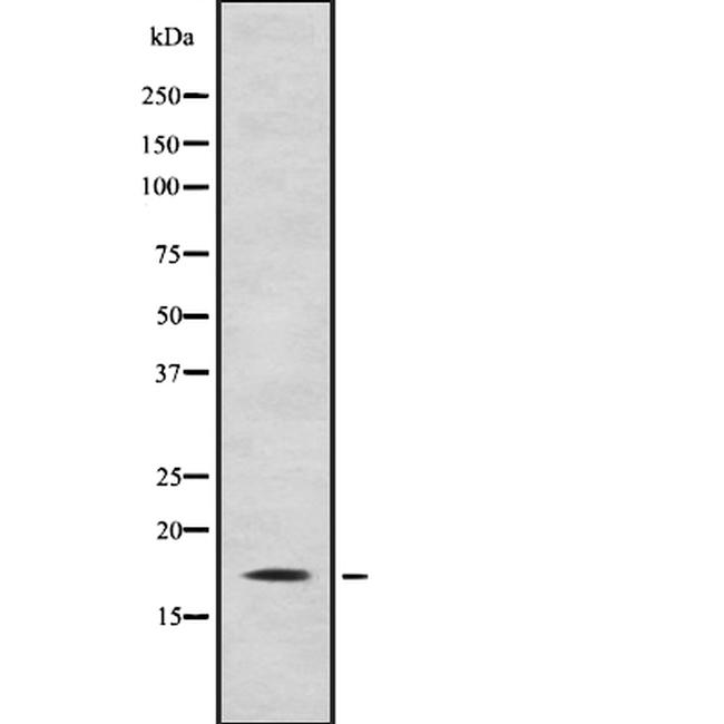 CITED4 Antibody in Western Blot (WB)