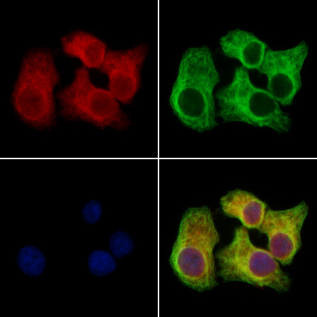 Clathrin Heavy Chain Antibody in Immunocytochemistry (ICC/IF)