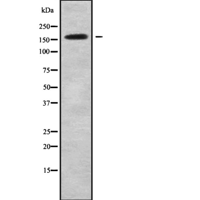 CNTNAP1 Antibody in Western Blot (WB)