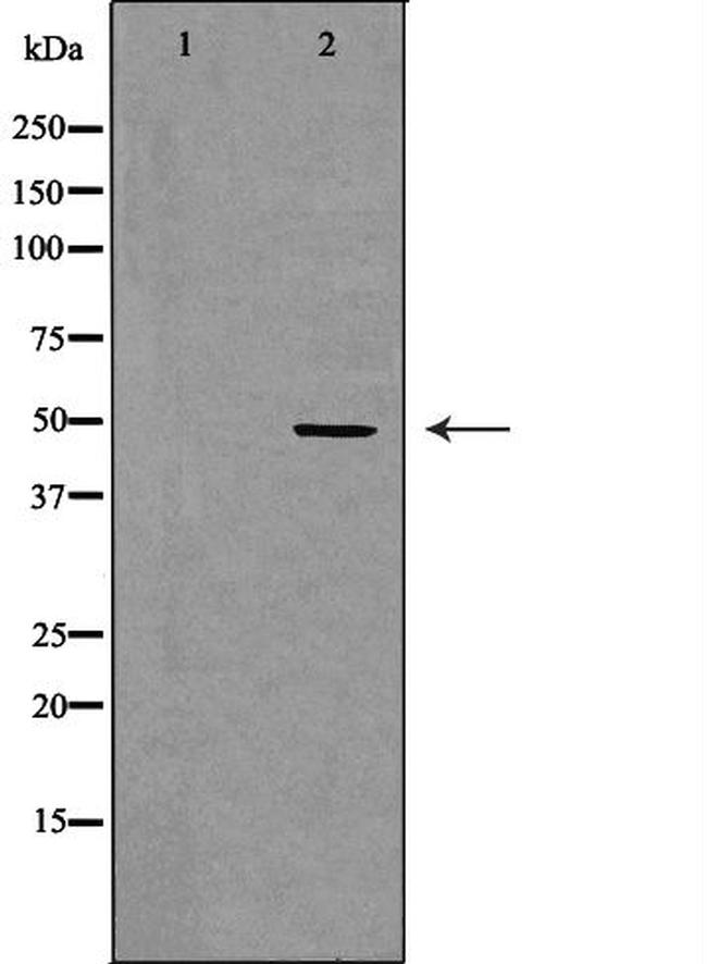 CD116 Antibody in Western Blot (WB)