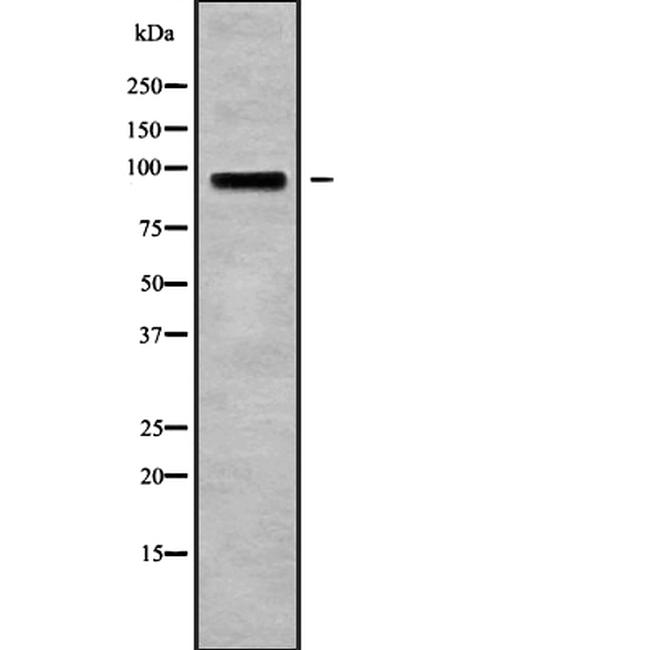 CSF3R Antibody in Western Blot (WB)