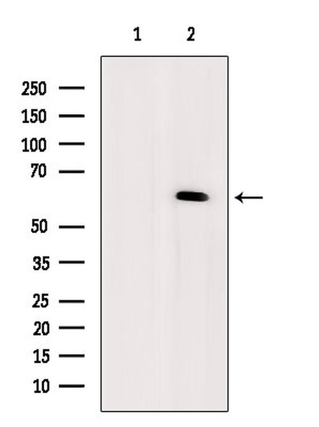 CTDSPL2 Antibody in Western Blot (WB)