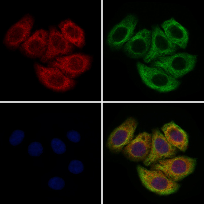 CUBN Antibody in Immunocytochemistry (ICC/IF)
