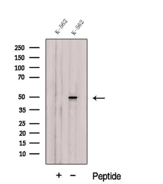 CUG-BP2 Antibody in Western Blot (WB)
