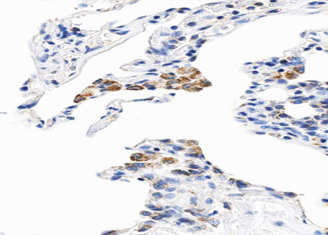 Cytochrome B5 Antibody in Immunohistochemistry (Paraffin) (IHC (P))