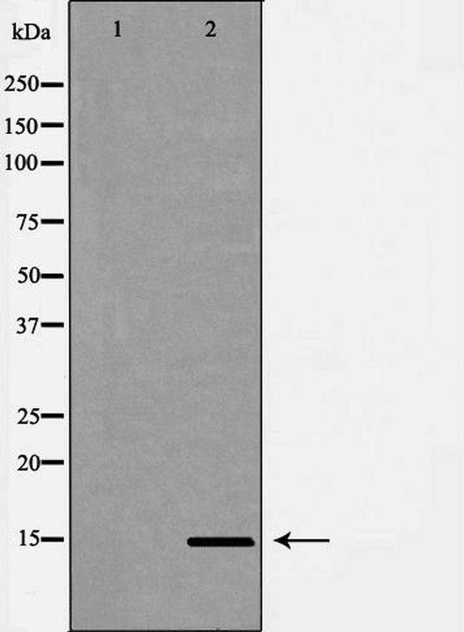 Cytochrome B5 Antibody in Western Blot (WB)