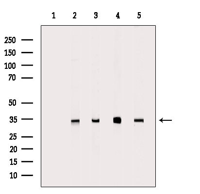CYB5R1 Antibody in Western Blot (WB)