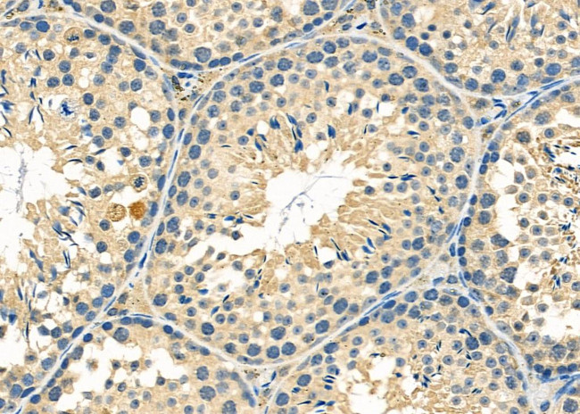 CYB5R2 Antibody in Immunohistochemistry (Paraffin) (IHC (P))
