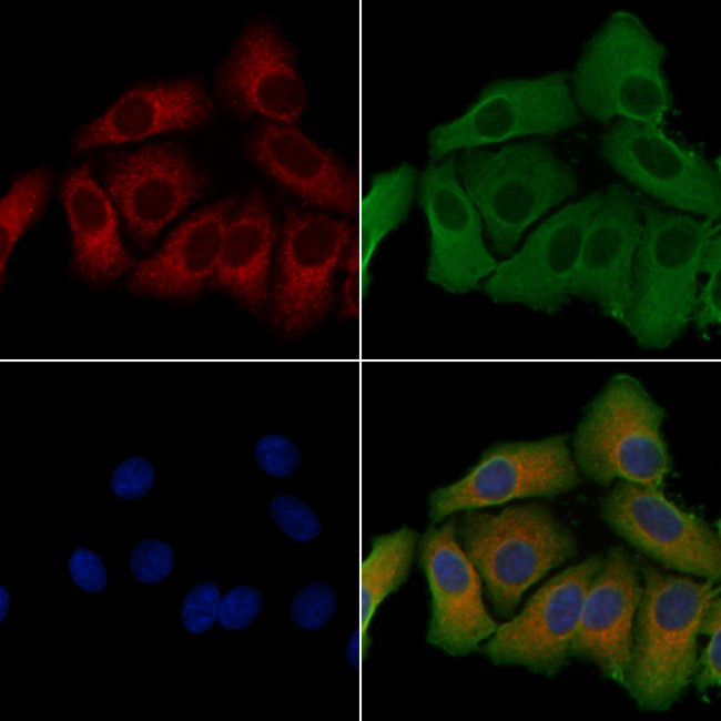CYB5R3 Antibody in Immunocytochemistry (ICC/IF)