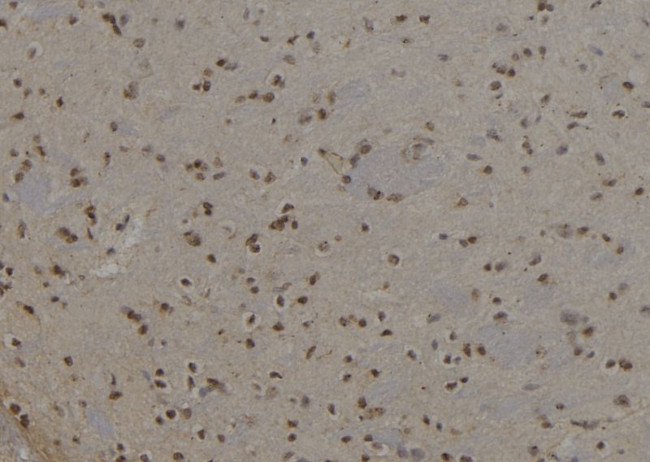 Cytokeratin 6A Antibody in Immunohistochemistry (Paraffin) (IHC (P))
