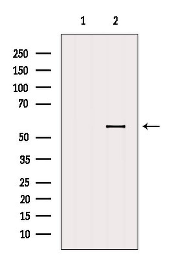HIP55 Antibody in Western Blot (WB)