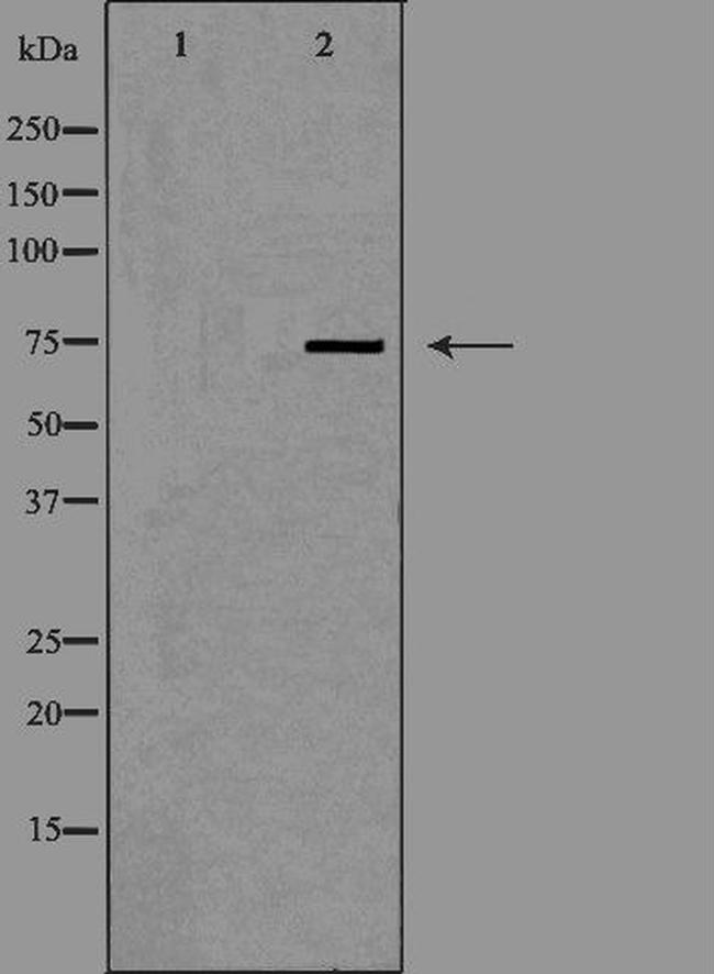 DCP1A Antibody in Western Blot (WB)