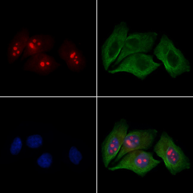 DDX18 Antibody in Immunocytochemistry (ICC/IF)