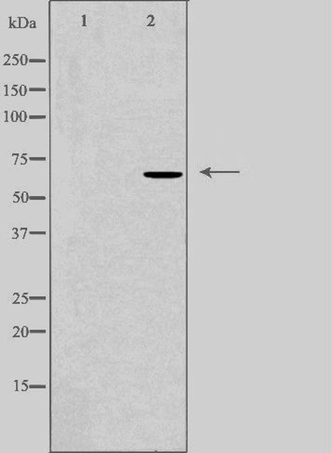 DDX52 Antibody in Western Blot (WB)