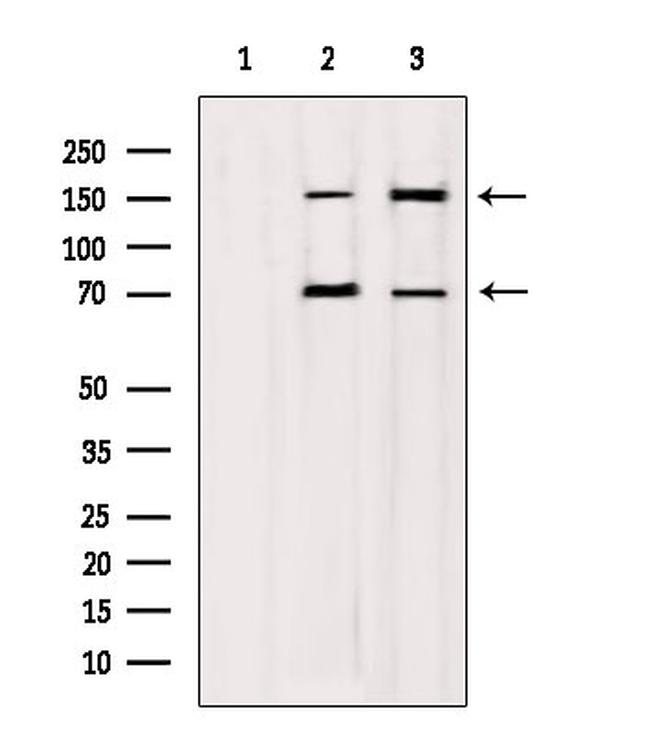DIAPH1 Antibody in Western Blot (WB)
