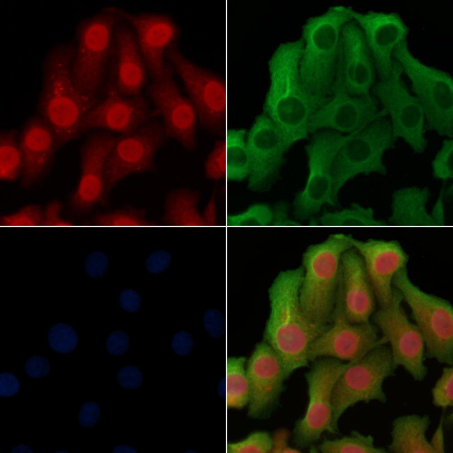 RNA pol II CTD Antibody in Immunocytochemistry (ICC/IF)