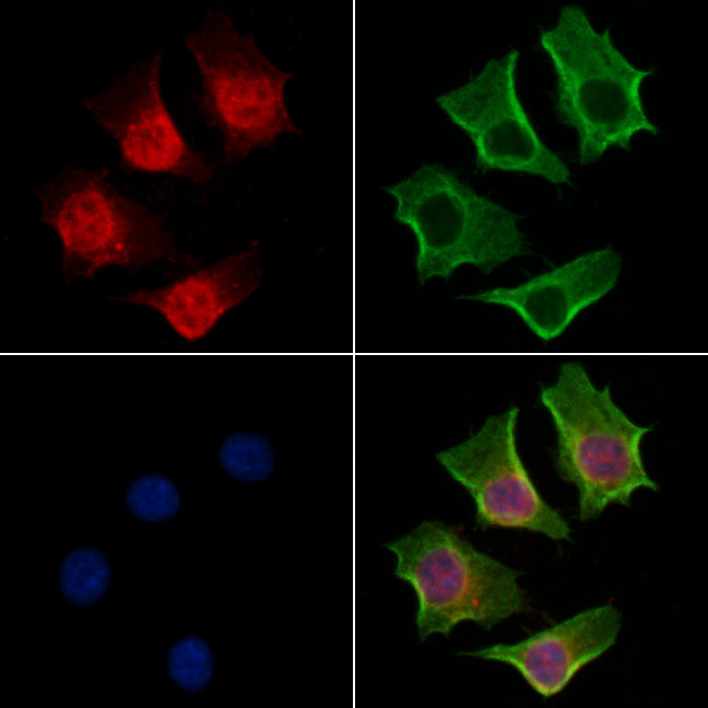 POLQ Antibody in Immunocytochemistry (ICC/IF)