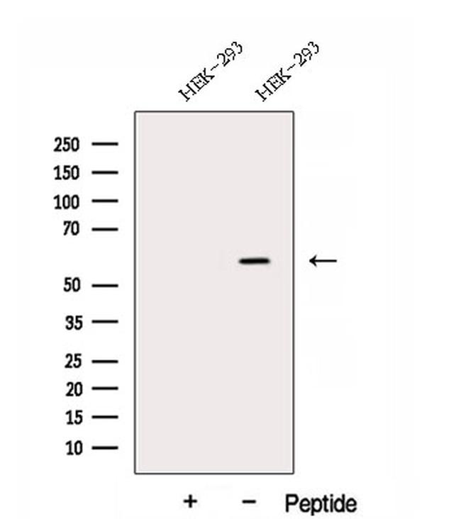 DNAJC7 Antibody in Western Blot (WB)
