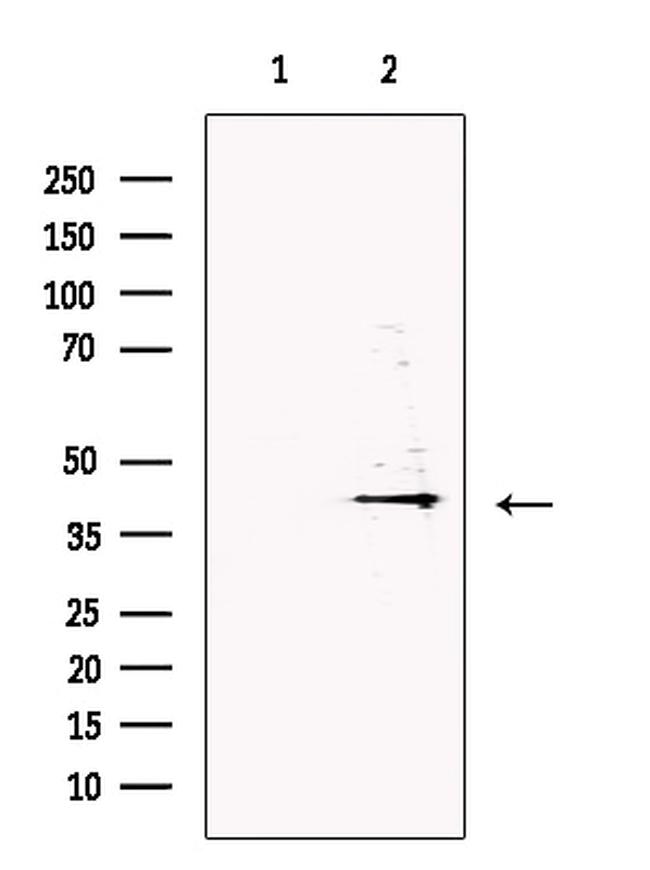 DNase II Antibody in Western Blot (WB)