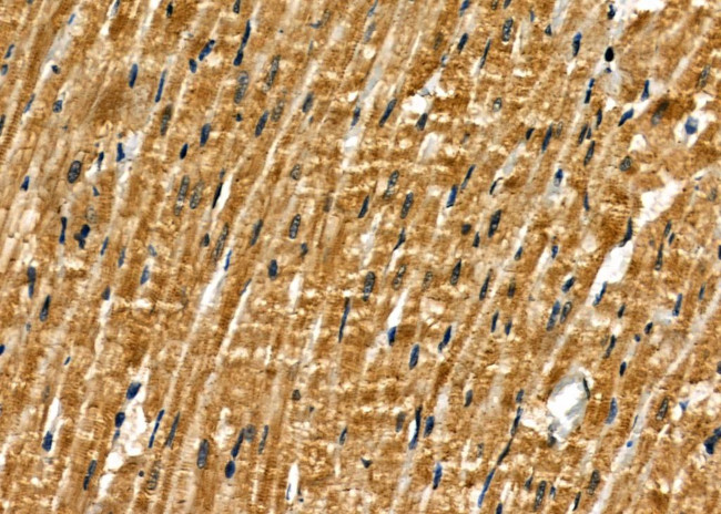 DOK6 Antibody in Immunohistochemistry (Paraffin) (IHC (P))