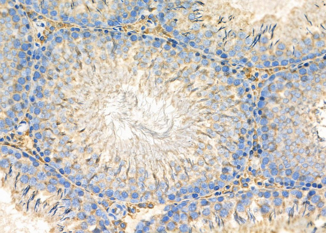 Desmoplakin Antibody in Immunohistochemistry (Paraffin) (IHC (P))