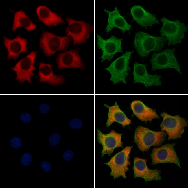DTX4 Antibody in Immunocytochemistry (ICC/IF)