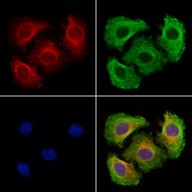 MAPRE3 Antibody in Immunocytochemistry (ICC/IF)