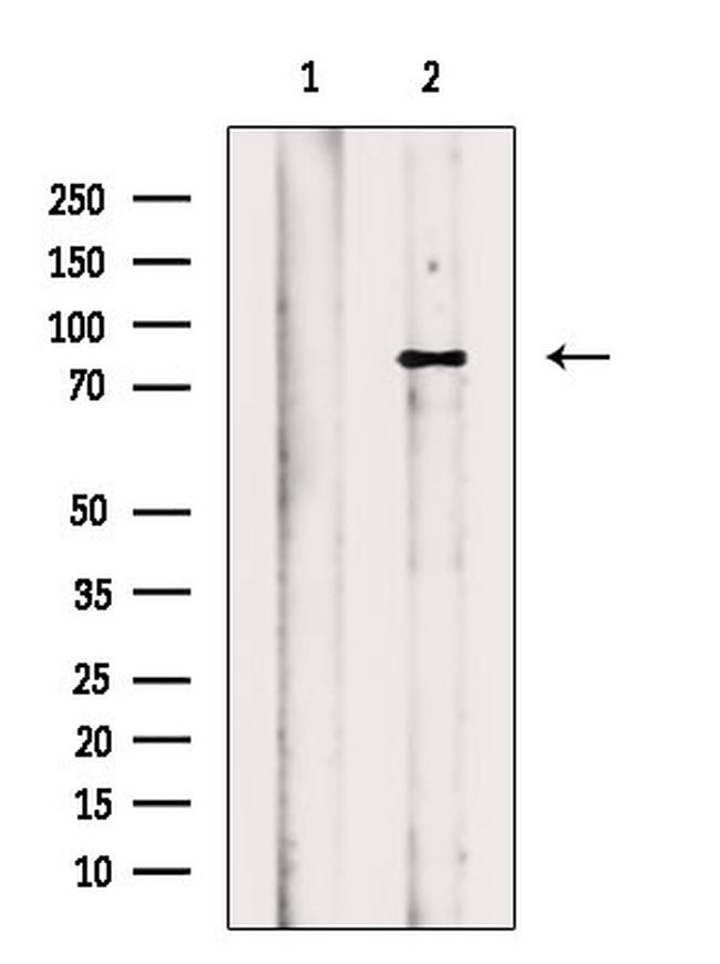 EEF2K Antibody in Western Blot (WB)
