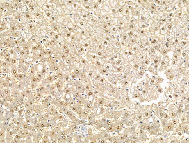 EIF4ENIF1 Antibody in Immunohistochemistry (Paraffin) (IHC (P))
