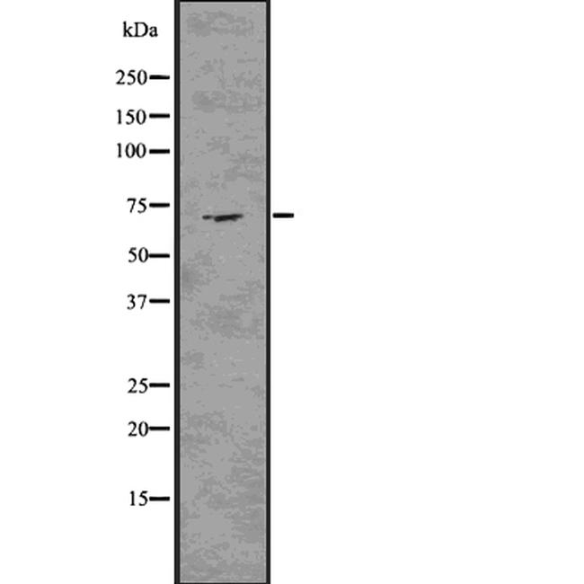 Elastin Antibody in Western Blot (WB)
