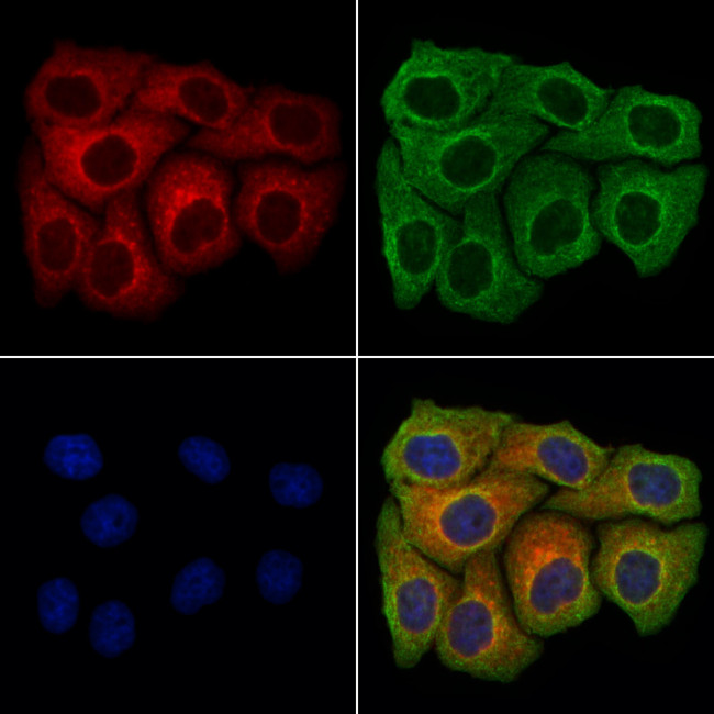 Endomucin Antibody in Immunocytochemistry (ICC/IF)